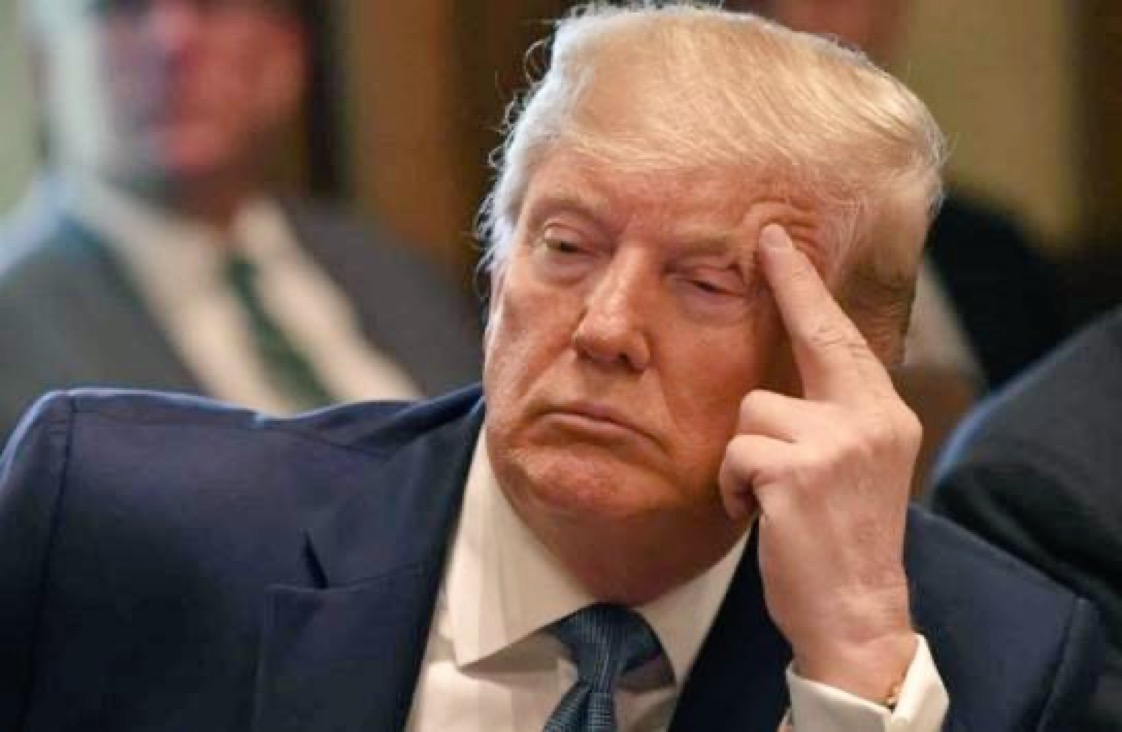 Trump'a Kronik Venöz Yetmezlik Teşhisi Konuldu
